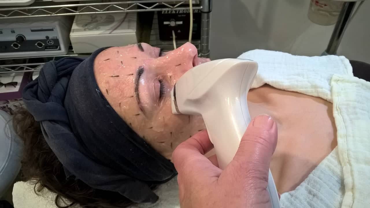 thermage okozhatja az arc zsírvesztését